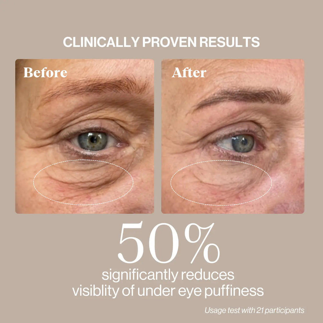 EYE REVIVE CREAM avec LYMPHACTIVE™