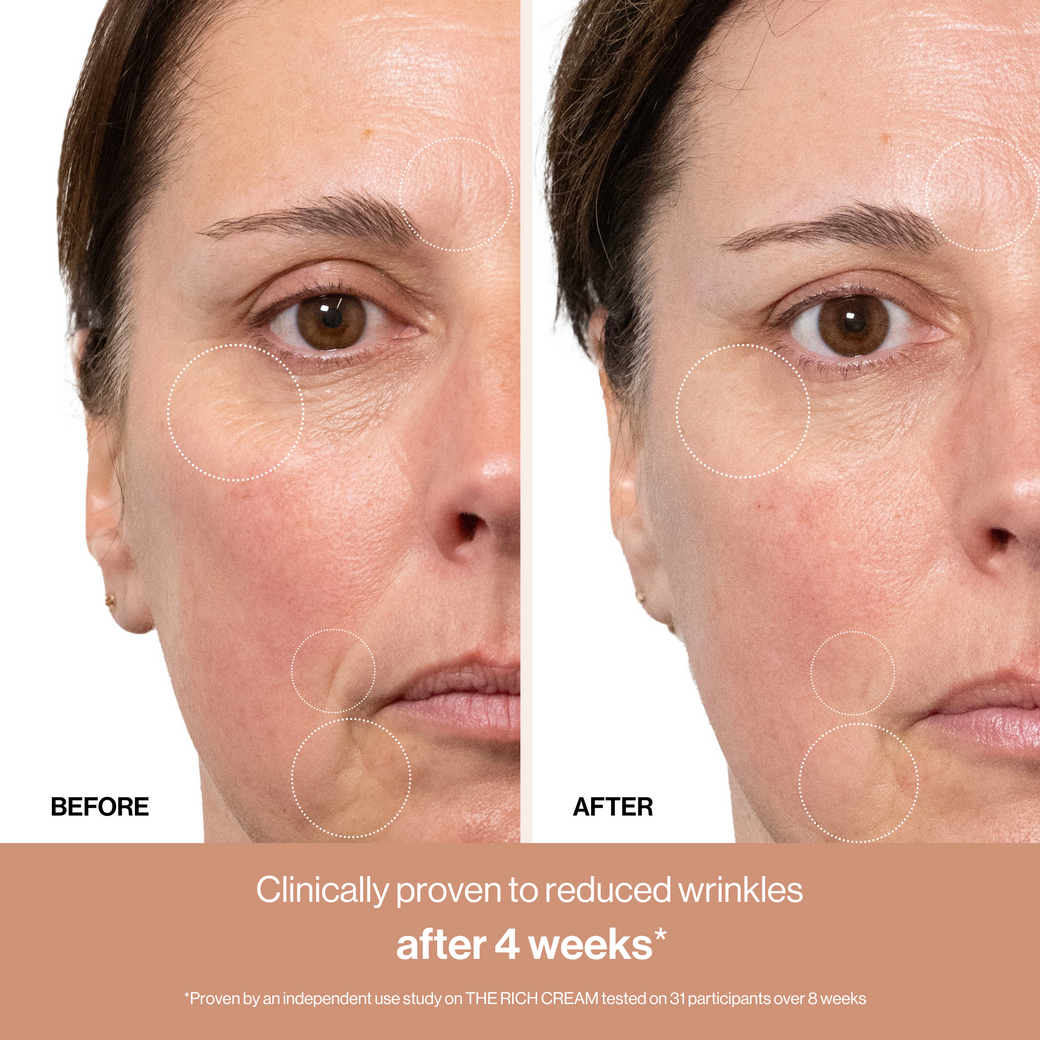 Die reichhaltige Creme mit Lymphactive™ 