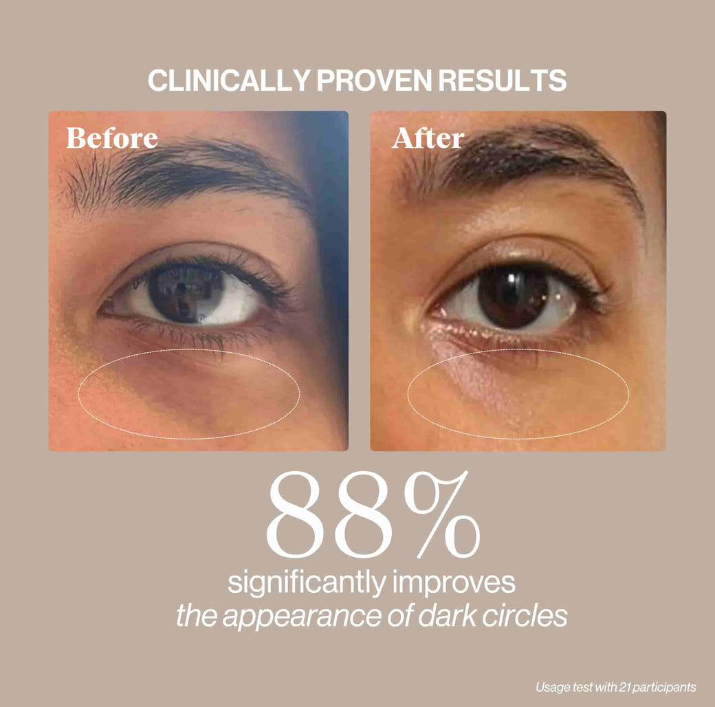 EYE REVIVE CREAM + EYE PATCHES