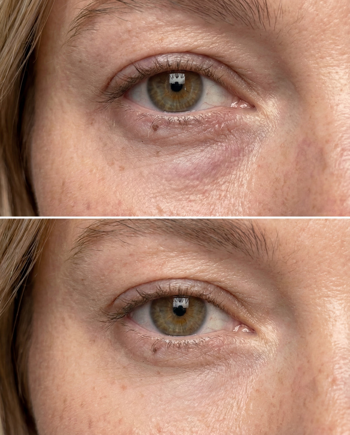 Eye Revive Cream
