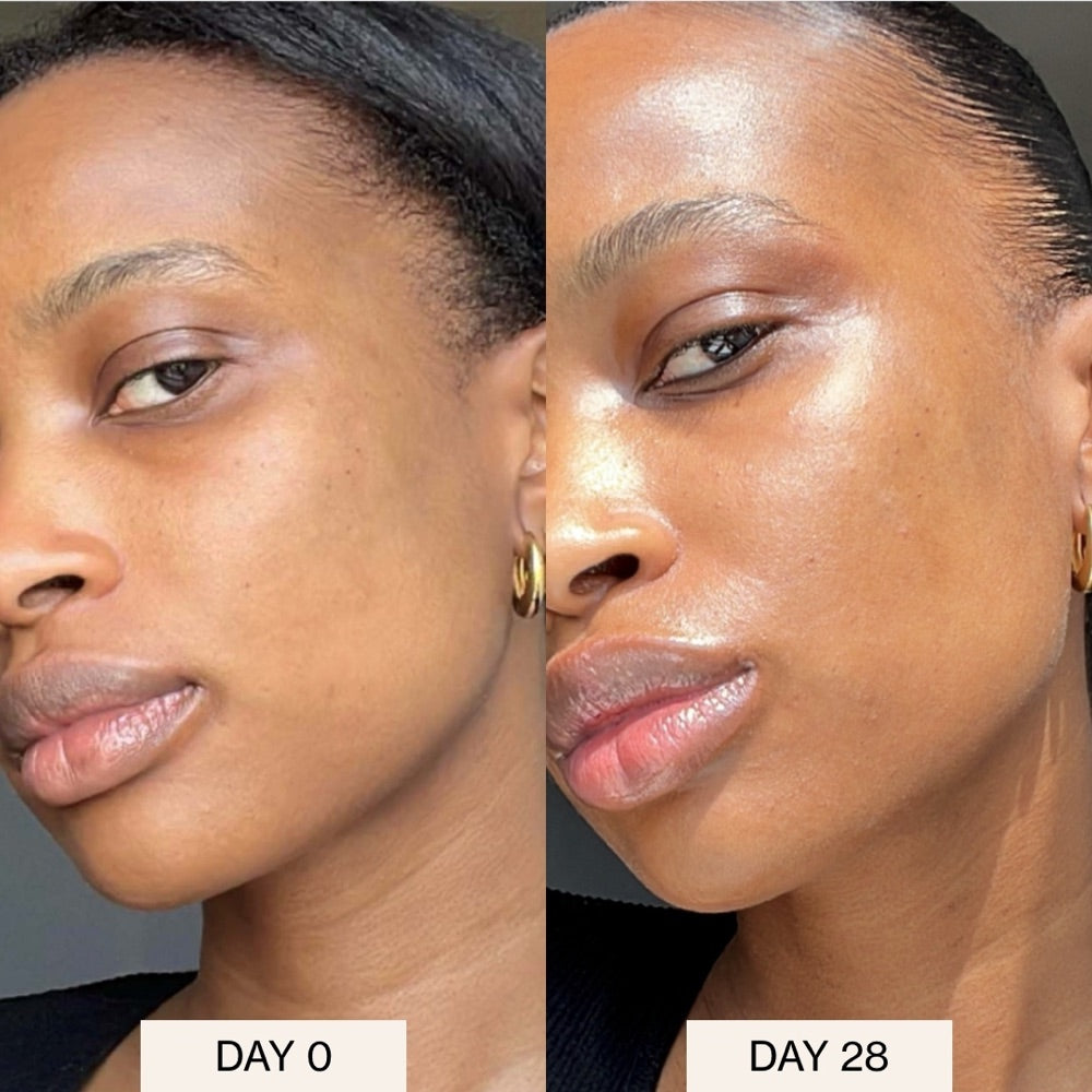 IRAYE customer